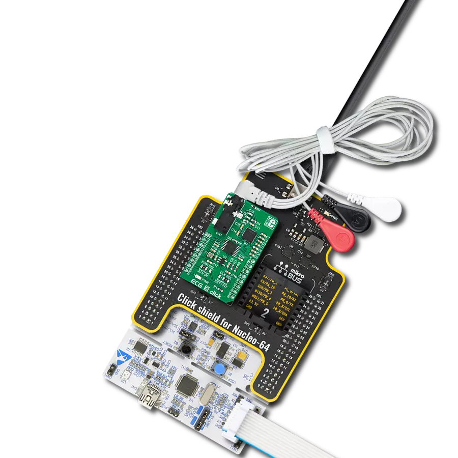 Your heart's storyteller based on the MAX30003 and STM32G071RB