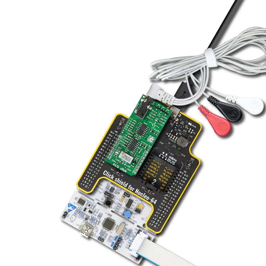 Advanced heart monitoring with MCP609 and STM32G071RB